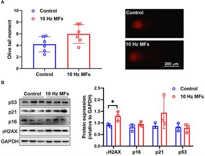 Exposure to 10 Hz Pulsed Magnetic Fields Do Not Induce Cellular Senescence in Human Fetal Lung Fibroblasts